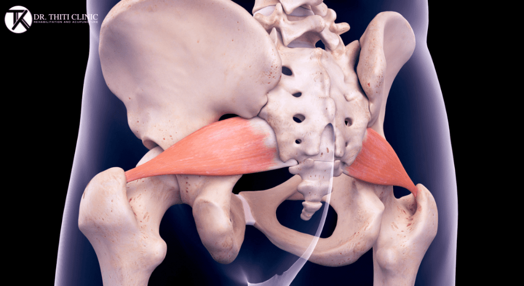 piriformis